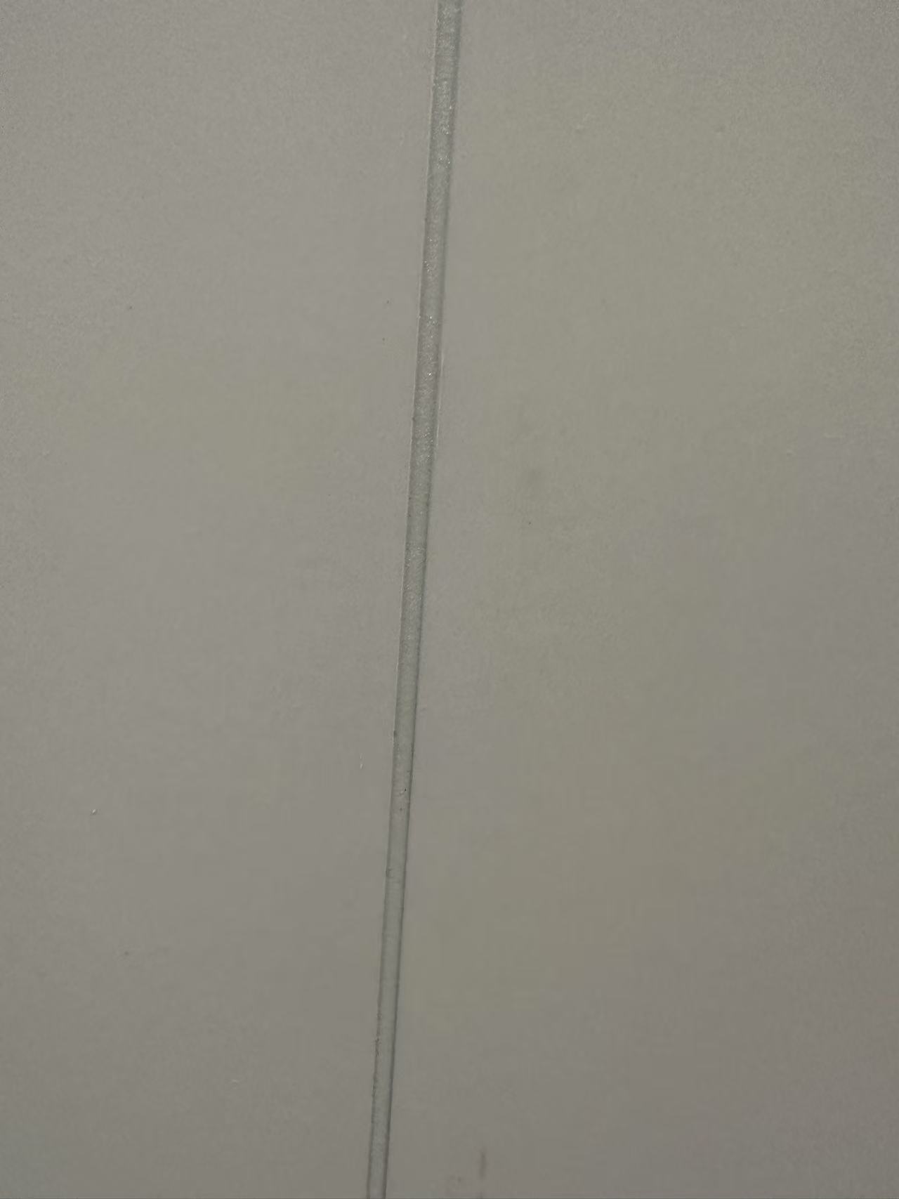 美缝案例分享