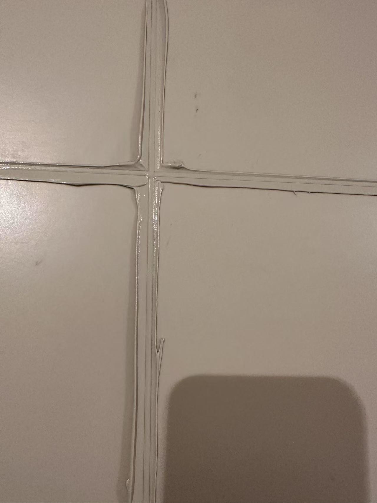 美缝案例分享