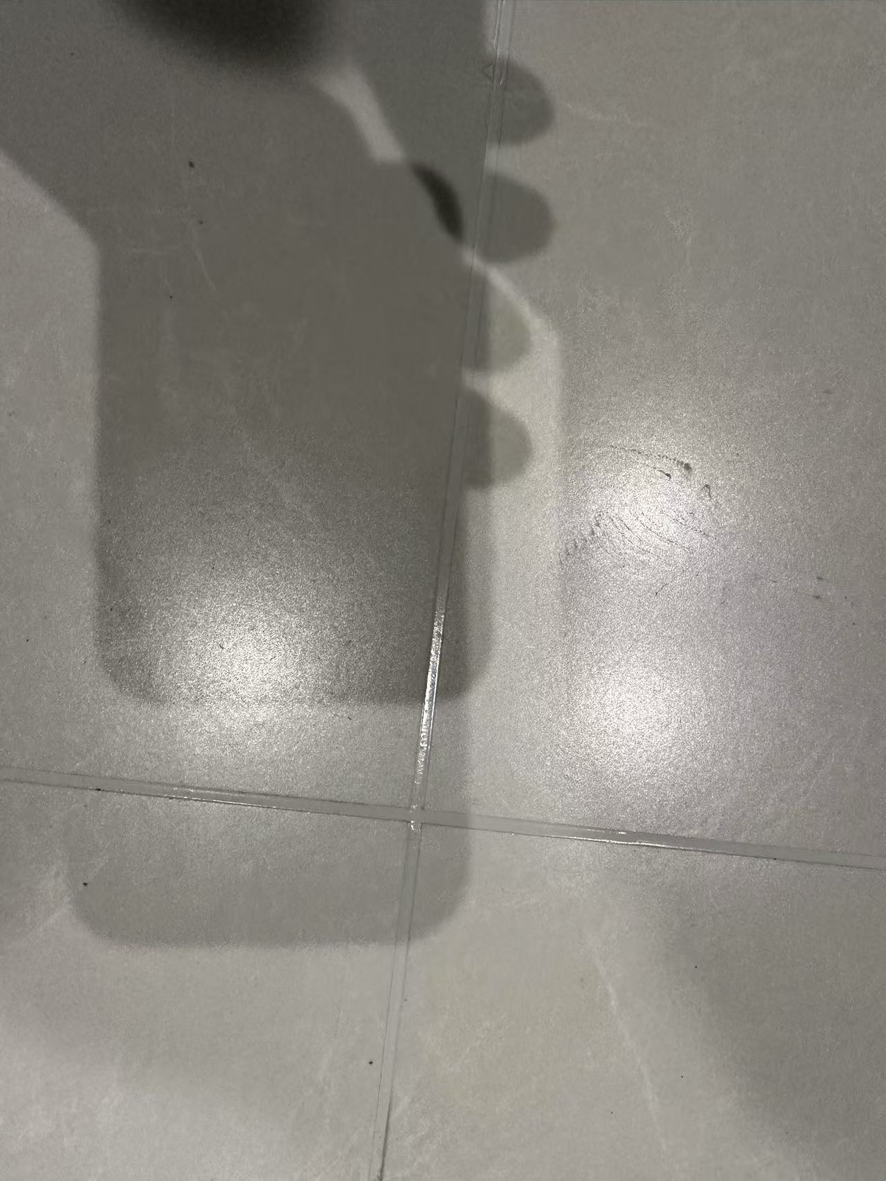 美缝案例分享
